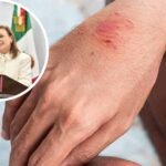 Gobernadora aclara que no hay nuevos casos de rabia en Veracruz