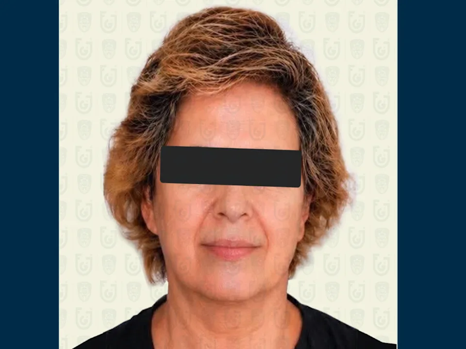 Erika “N”, suegra de exreina de belleza Carolina Flores, dice que la mató por “accidente”
